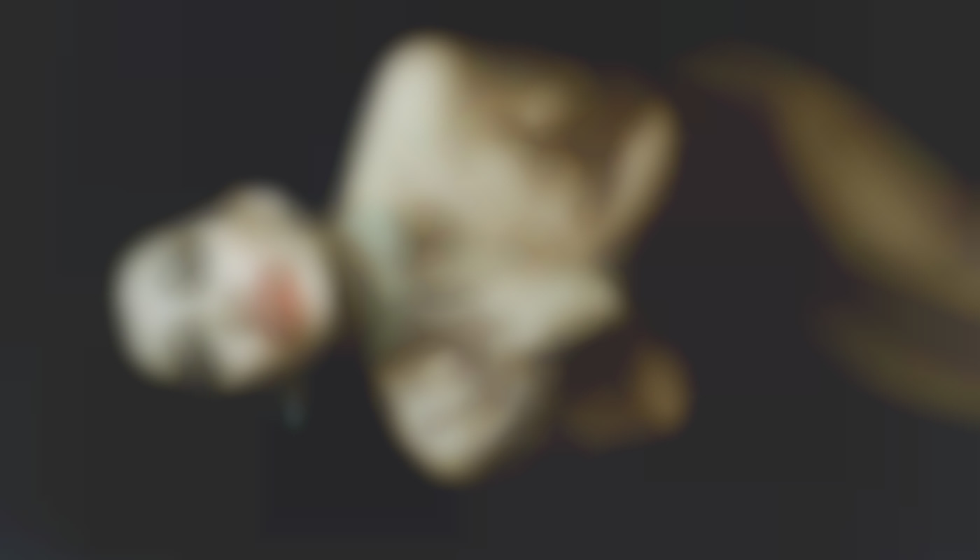 Exploring The Technology Behind AI-generated Undressed Images
